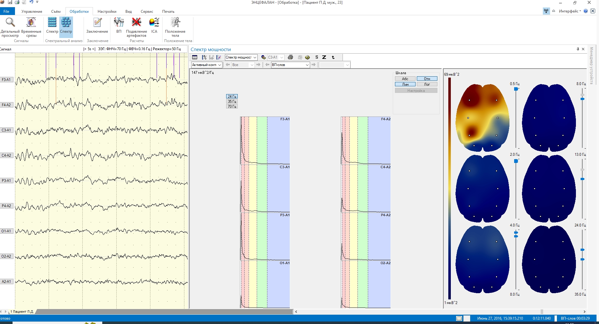 Энцефалан-ВП