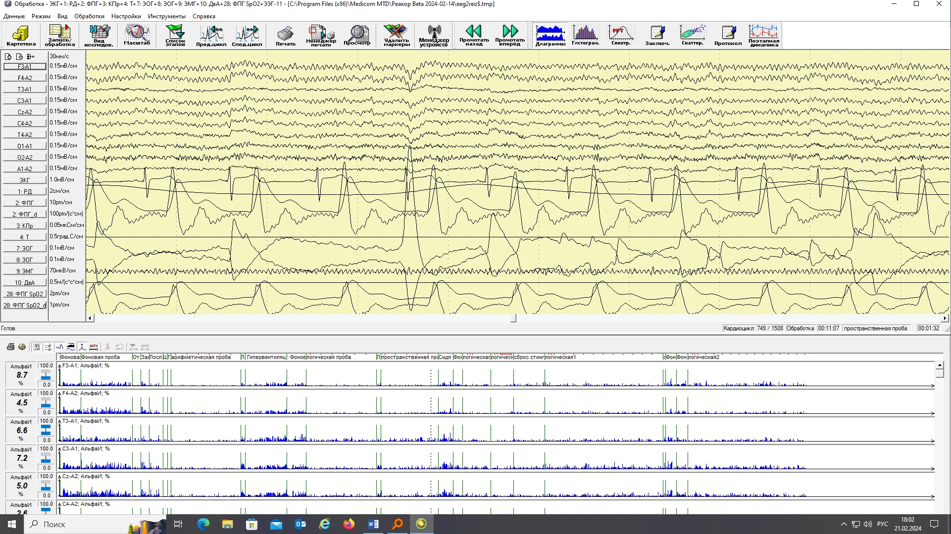 Энцефалан-СА